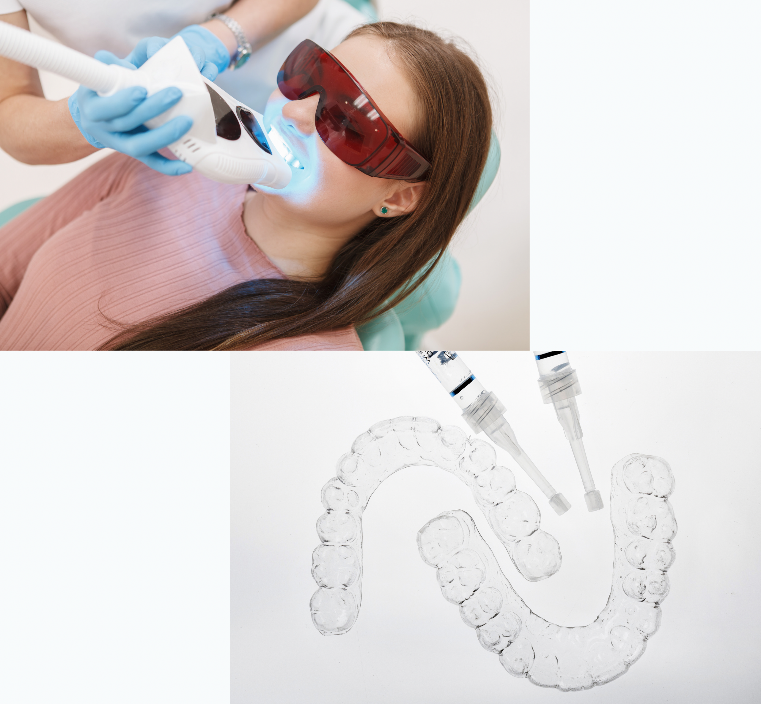 デュアルホワイトニング