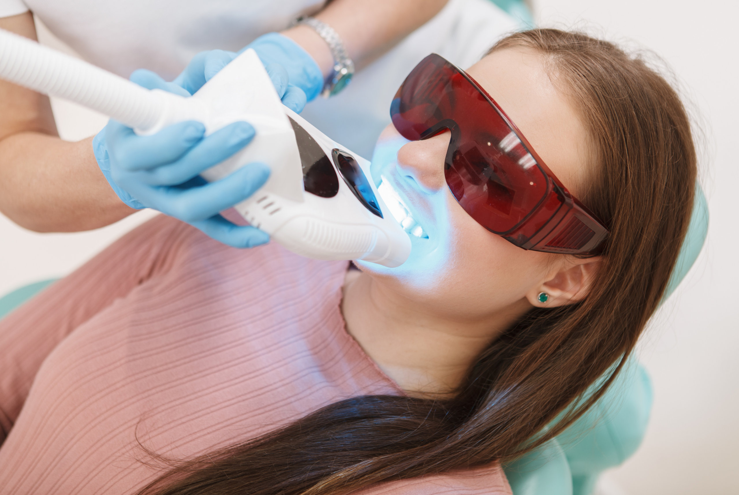 オフィスホワイトニング